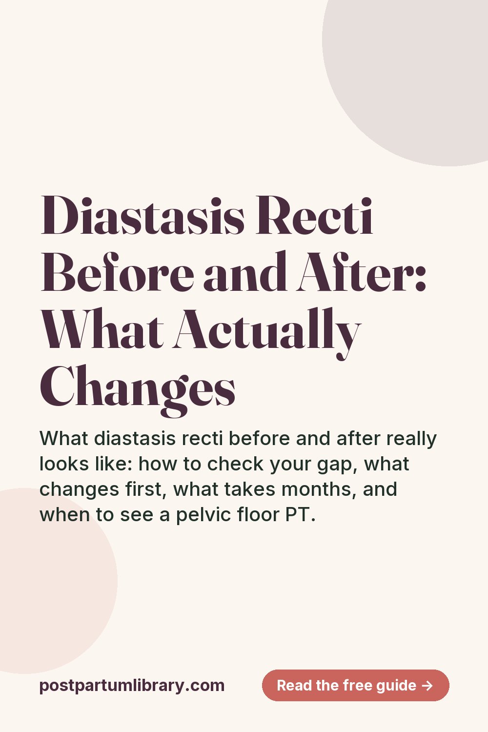 Diastasis Recti Before and After: What Actually Changes (pin)
